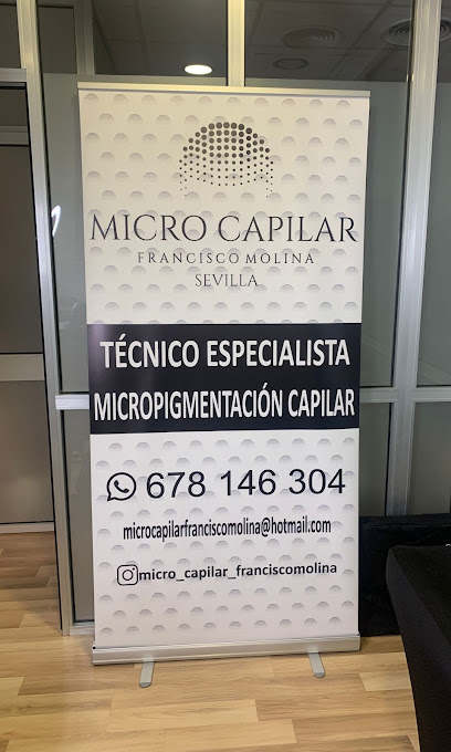 Micro capilar Francisco Molina - Opiniones