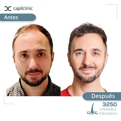 CapilClinic Madrid - Opiniones