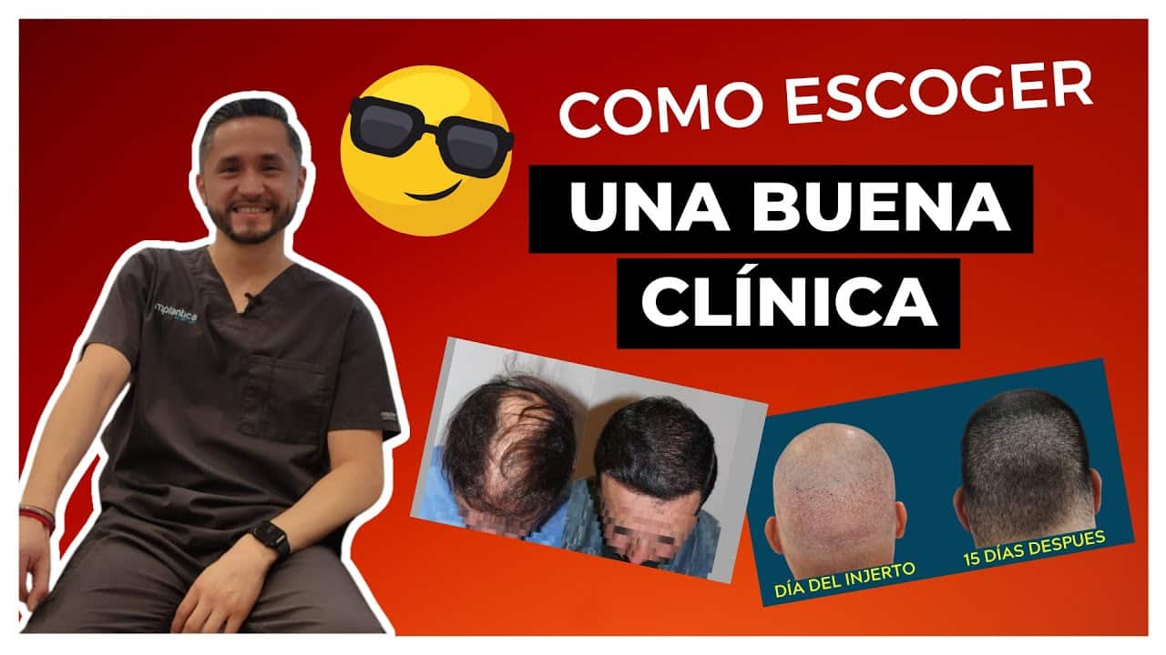 Cómo Identificar una Clínica de Injerto Capilar Confiable