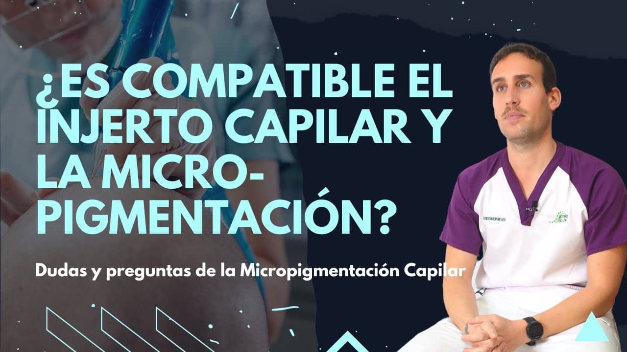 Los Avances en Micropigmentación Capilar como Complemento al Injerto