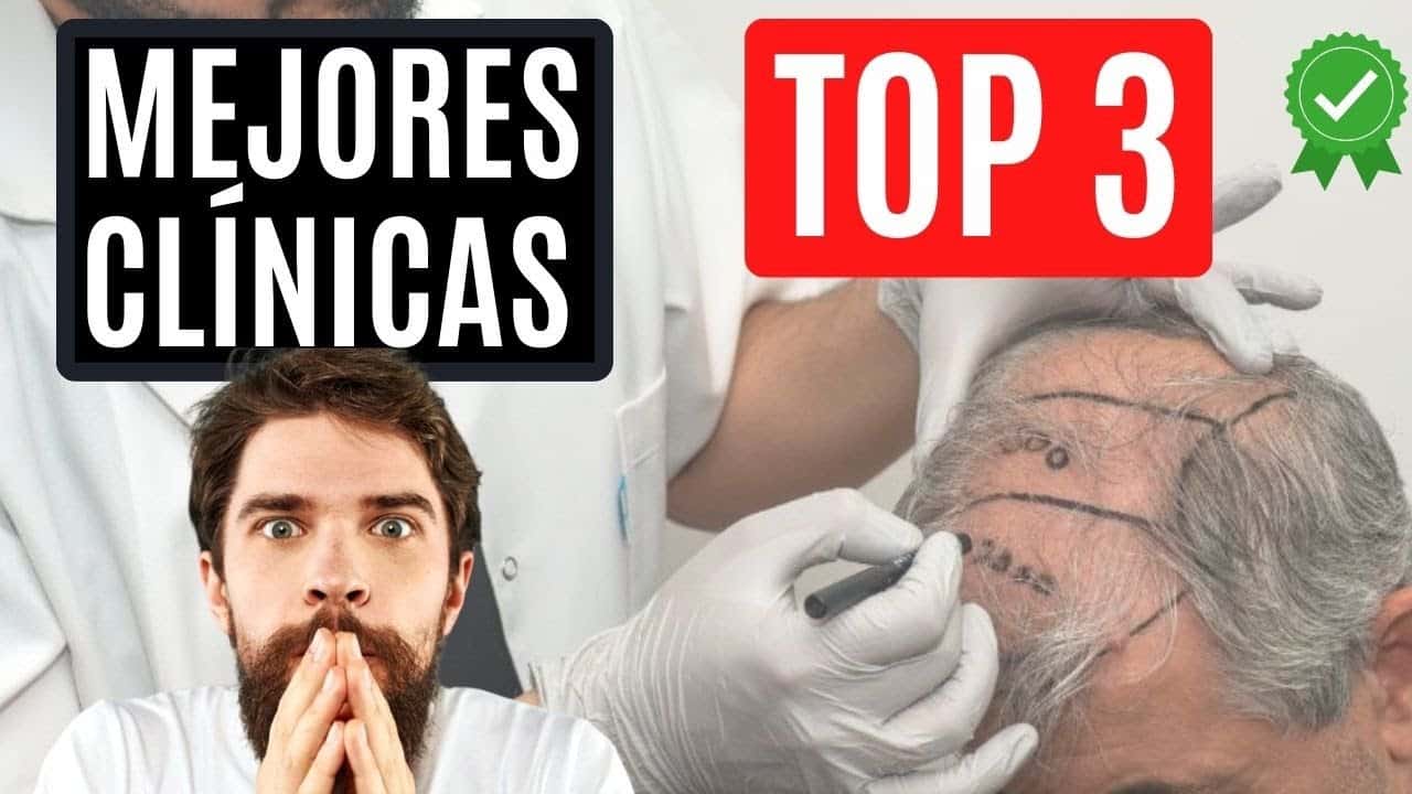 Top 5 Regiones en España para un Injerto Capilar de Calidad